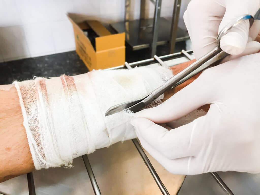 Doctor cutting a bandage on an injury caused by a dog bite